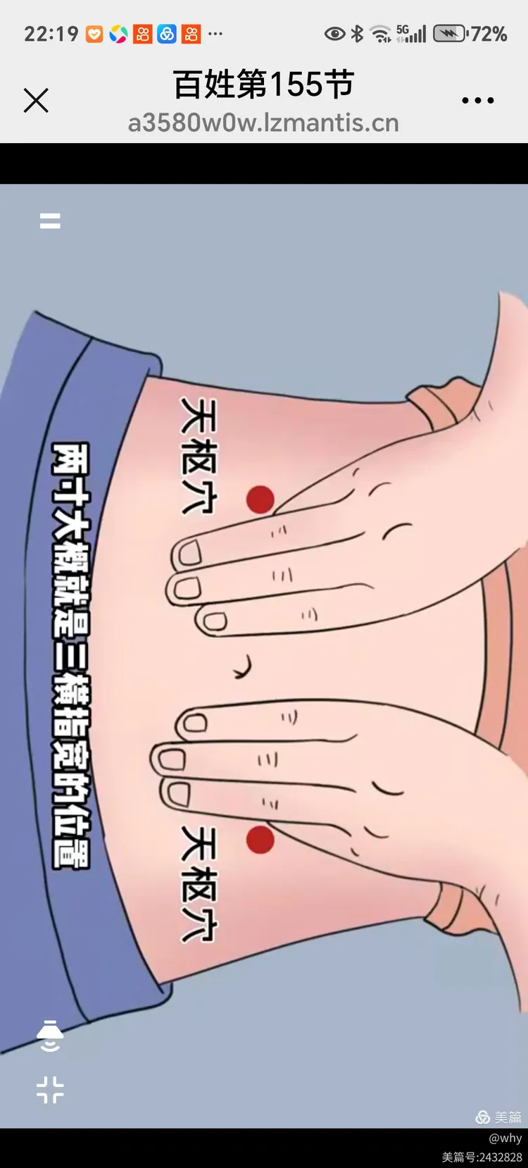 便祕可致心脑血管血管病及癌症予防可以采用按摩天枢穴早五至七点揉腹